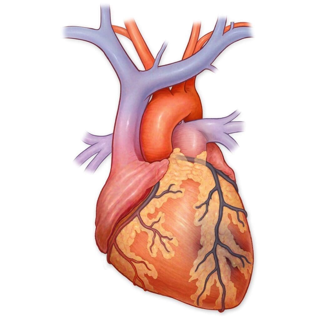 Myocardial Infarction An Unavoidable Risk